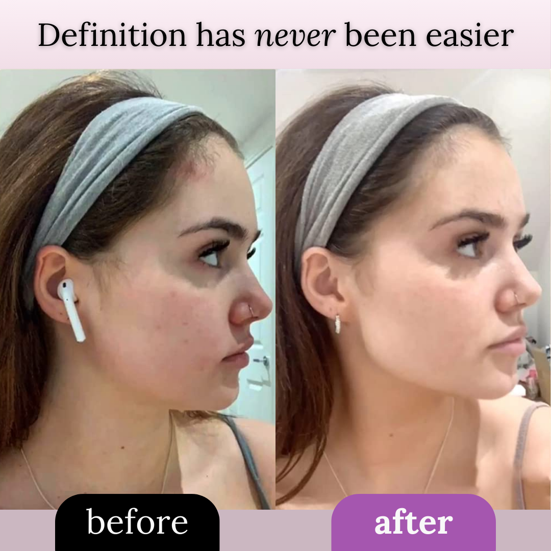 LiftBand™ Jawline Sculptor