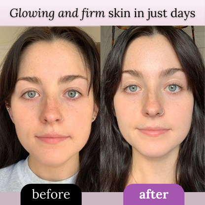 Radiance™ Facial Lifter